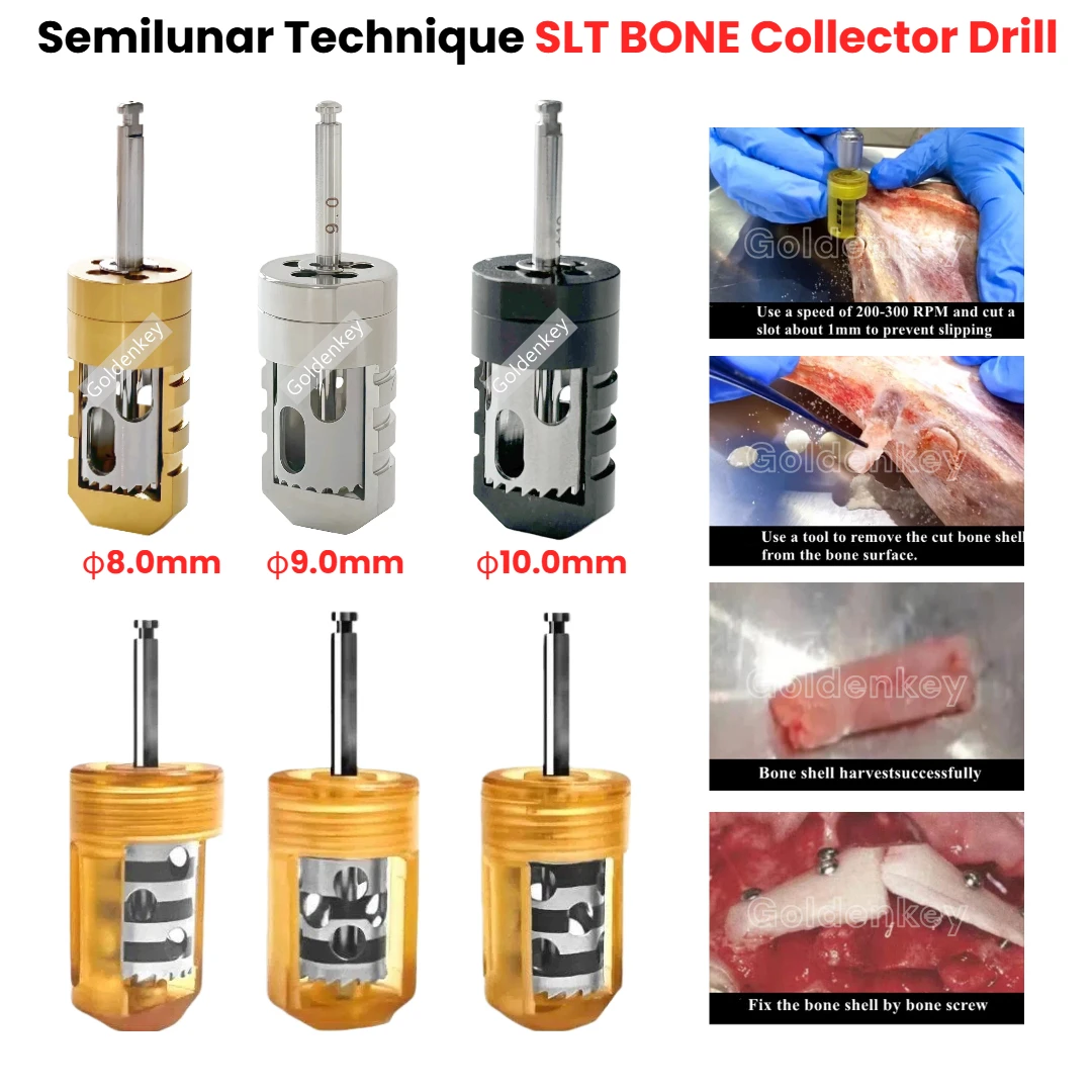 

Dental SLT Easy Bone Collector Semilunar Technique GBR SLT Drill Implant Semilunar Shell Bone Argumentation Harvest EBC HalfMOON
