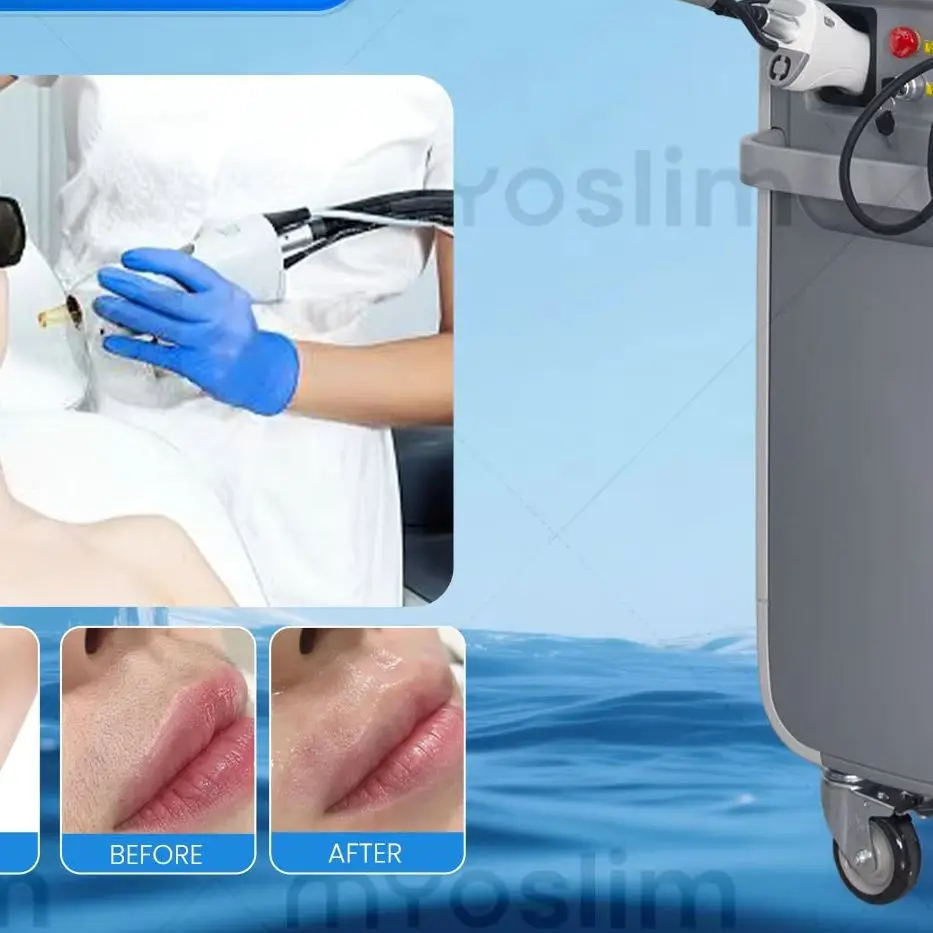 Professional Vertical 755 Alexandrite Long Pulse Lase Hair Removal Equipment Skin Rejuvenation Pigment & Vascular Therapy Device