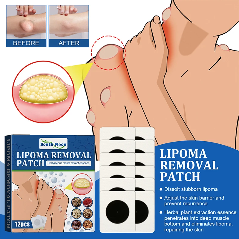 12pcs Lipoma Removal Patch Removes Lipomas Fibroids Subcutaneous Lumps For Pain Relief Stickers Chinese Herbal Medicine Plaster