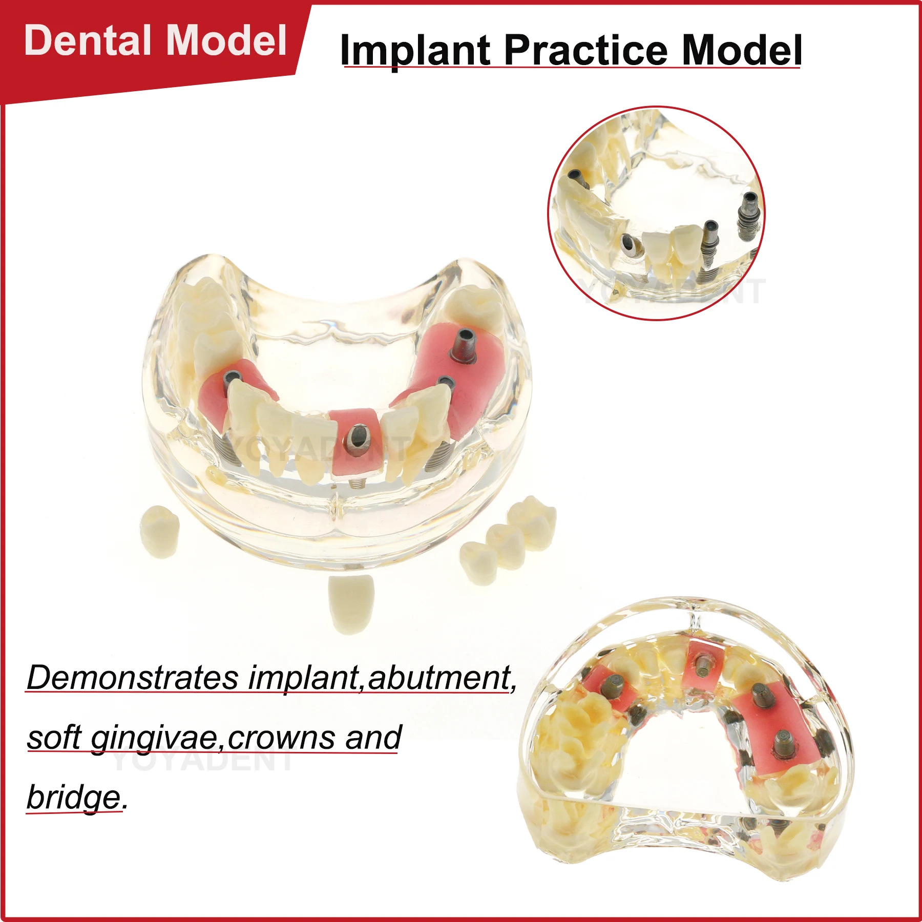 

Dental Teeth Models With Implant Supported Bridge Teaching Model M2005 For Studying Dentistry Products Demo