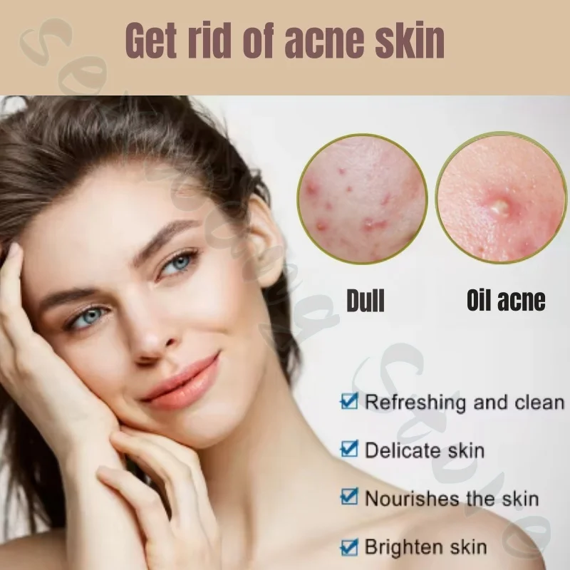 Plant moisturizing and moisturizing essence improves acne, absorbs oil, and absorbs pores and is gentle and not irritating