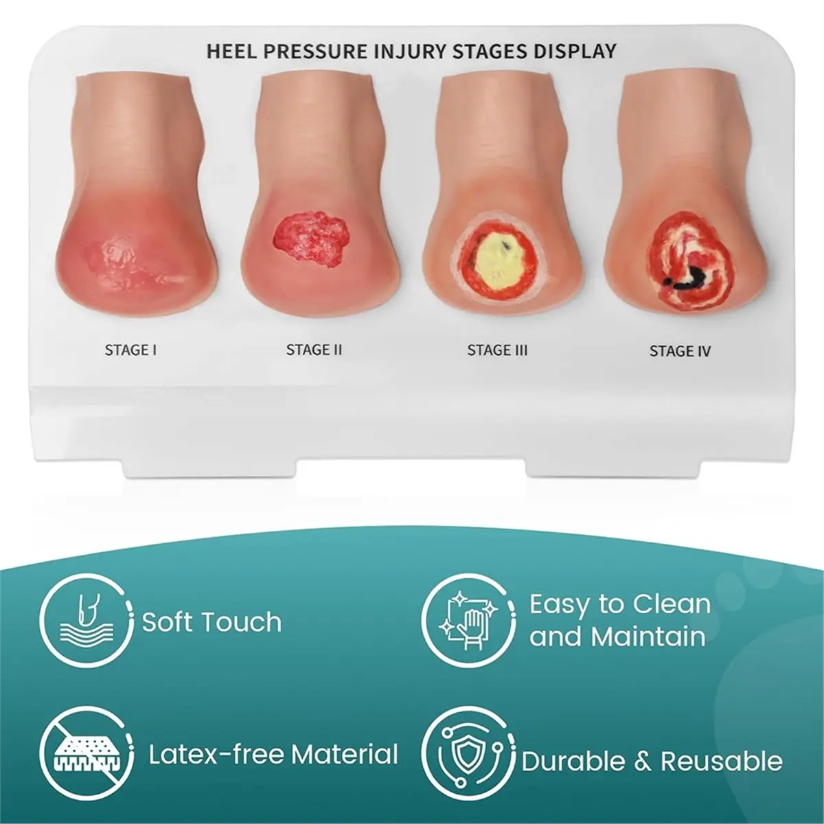 Heel Pressure Injury Stages Model, Heel Ulcer Demonstration Model, Bed Sore Stages Education Tool for Training