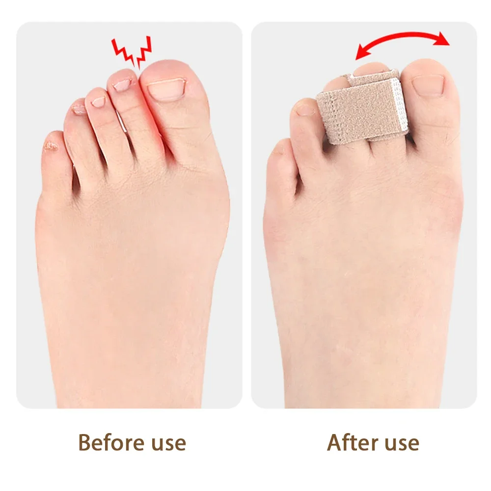 Premium Portable 1/2/5/10Pcs Hammer Straightener Splints Cushions Bandages for Correcting Crooked & Overlapping Toes Protector