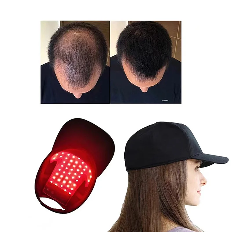 Red Light Therapy Helmet 630nm 850nm 940nm Red Light Therapy Hat For Hair Regrowth