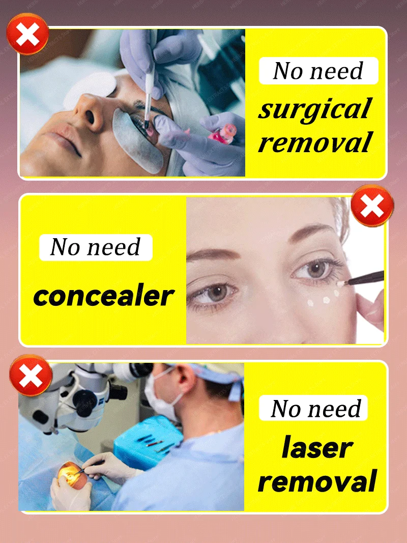 Snelle Oogzak Remover Retinol Anti-rimpel Verstevigende Huid Lichter Fijne Lijntjes Anti-donkere kringen Wallen Heldere Oogverzorging
