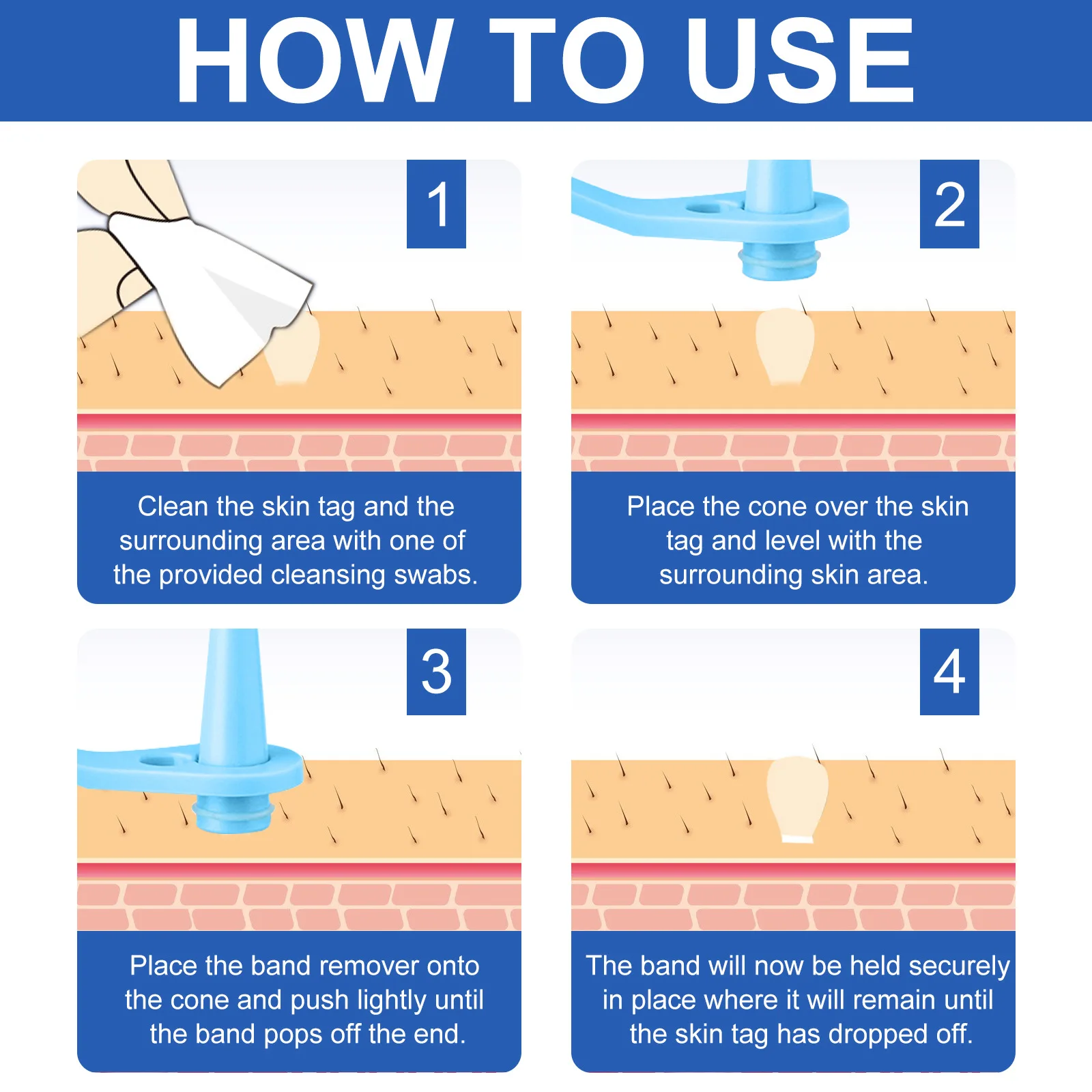 Kit d'élimination automatique des étiquettes cutanées à Double tête 2 en 1, pour petites à grandes étiquettes cutanées 1-9mm avec écouvillons nettoyants, outil de soins de la peau facile à utiliser
