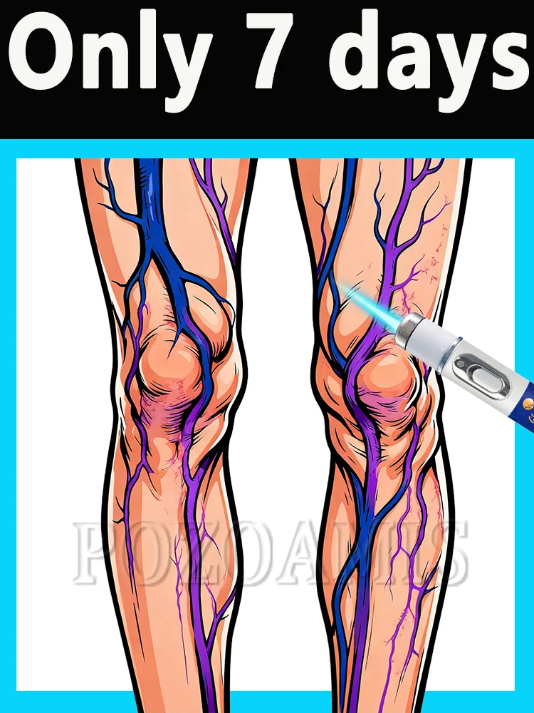 

Foot care varicose veins improvement relief