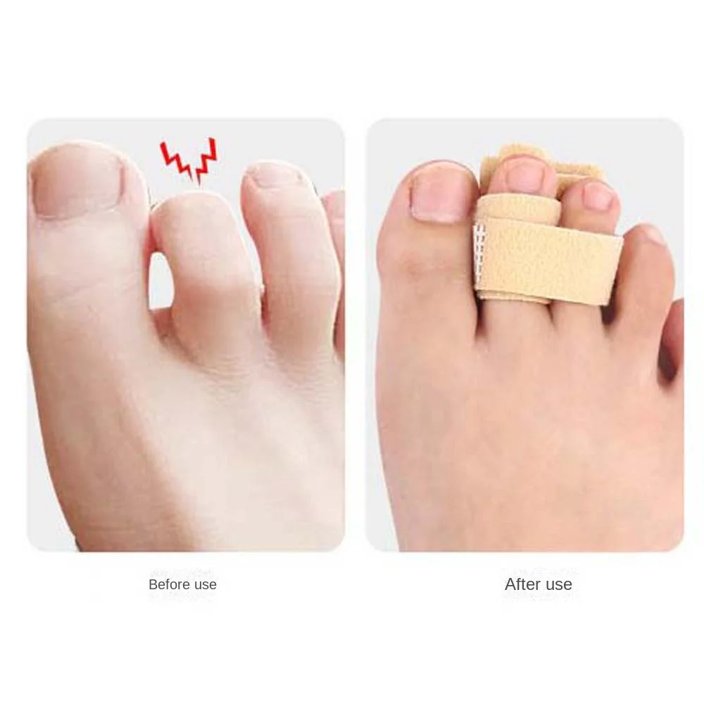 Straightening Toe Splint Support Joint Stabilizer Toe Joint Support Toe Fix Strap Protector Dislocation Fracture Aluminium Alloy