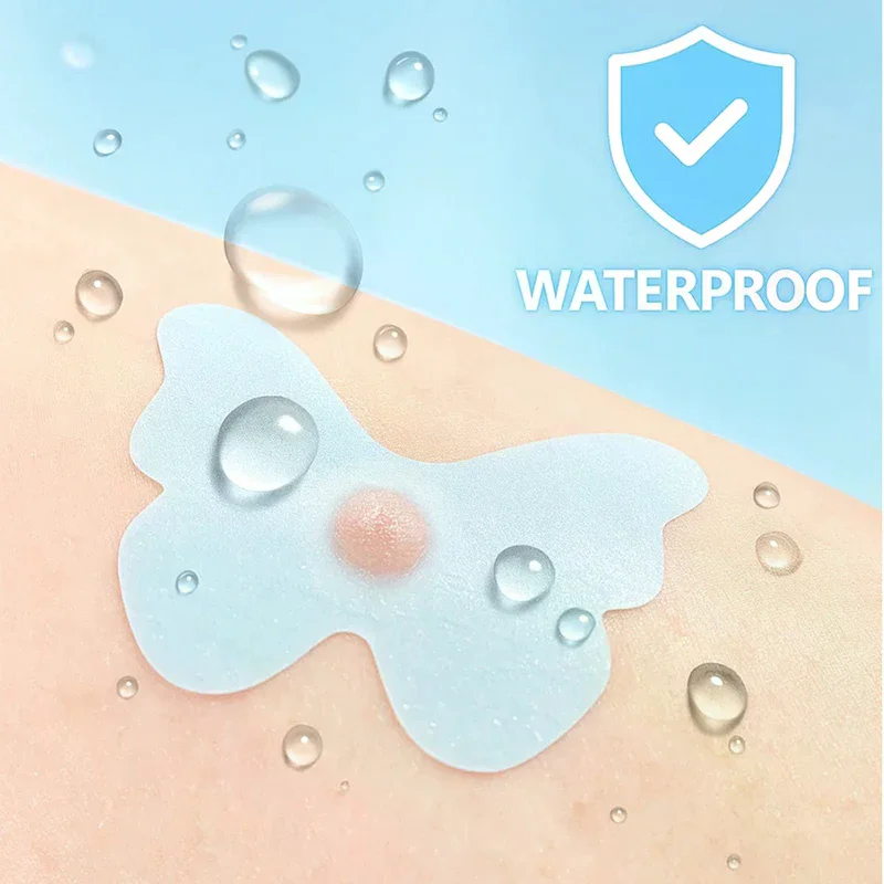 120/360개 나비 모양 여드름 패치 스티커 잡티 커버 0.1mm 여드름 치료 여드름 제거 스킨케어