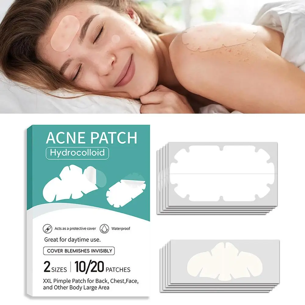 Patch maître de boutons fermés, 10/20/152/198 pièces, maquillage Invisible, masque d'absorption de la peau, respirant, soins pour sélections colloïdales Beau L2Q6