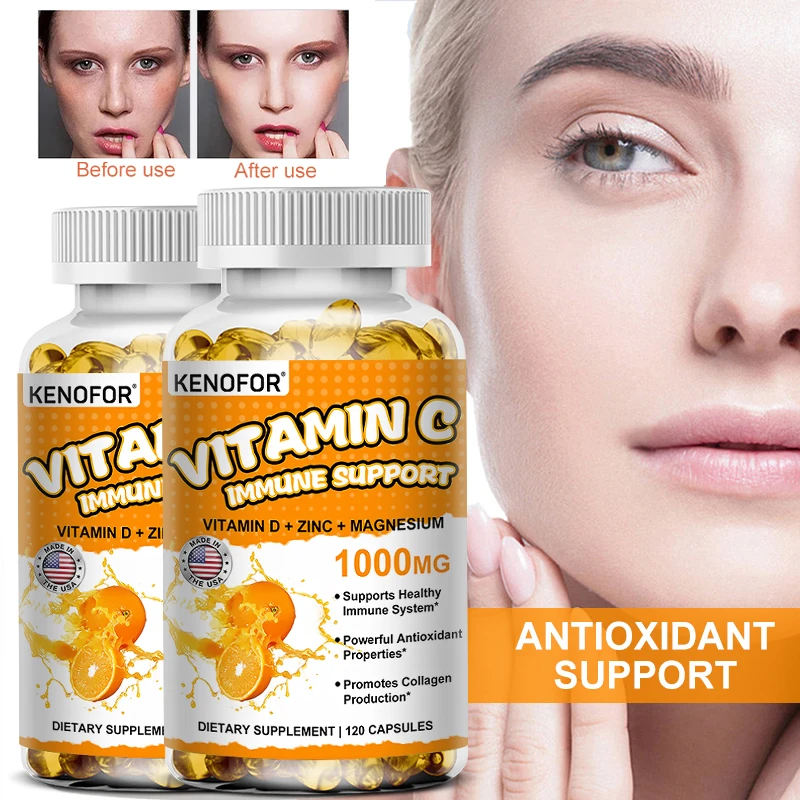 

KENOFOR Vitamin C Capsules, Containing Vitamin D, Zinc, Magnesium, Antioxidants, Collagen Regeneration, Skin & Immunity