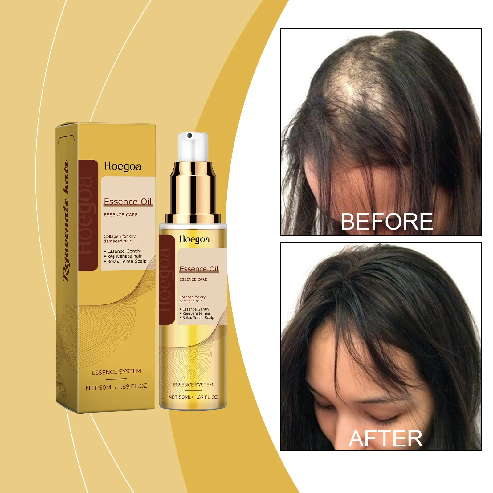 

Растительный уход за волосами, эфирное масло, лечение роста волос, лечение перхоти для кожи головы, профессиональный уход за кожей головы, сыворотка против выпадения волос