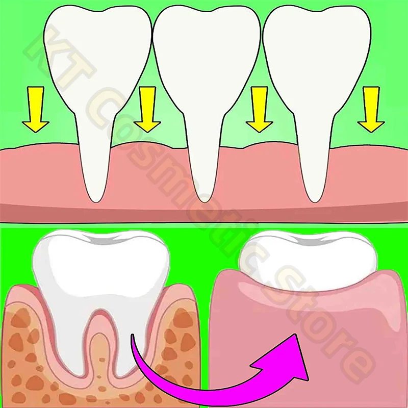 Rapid Repairing Gum Atrophy Toothpaste Effectively Relieve Dental Allergies Deep Cleaning Tooth Caries Damaged Teeth Care Serum