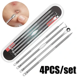 4 Pack Set Of Stainless Steel Double-Headed Blackhead Remover Acne Needle Facial Cleansing Pores Cleaning Facial Skin Care Tools