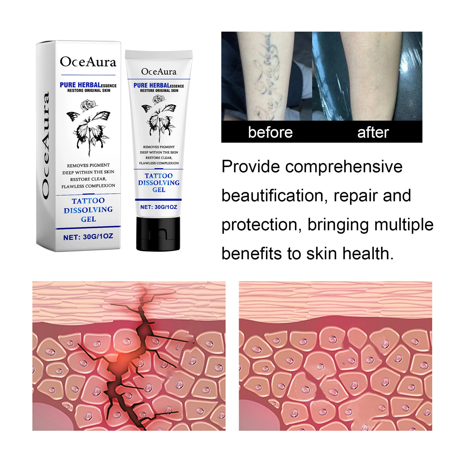 30 جرام جل تذويب الوشم مستخلص نباتي جل منظف الوشم سريع الفعالية كريم إزالة الوشم الاحترافي للعناية بعد الوشم