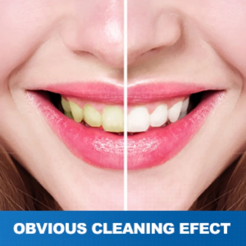 4 Modes Oral Irrigator Water Dental Flosser Cordless for Teeth Rechargeable IPX7 Waterproof Teeth Cleaner Home Travel Oral Care