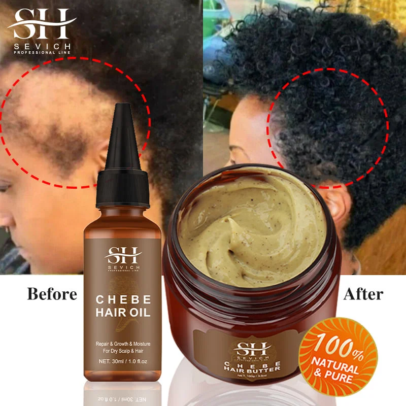 Schnelles Haar wachstum Set Chebe Öl Traktion Alopezie Haarmaske Anti Break Loss Haarwuchs Öl Kahlheit Behandlung Haarpflege produkte