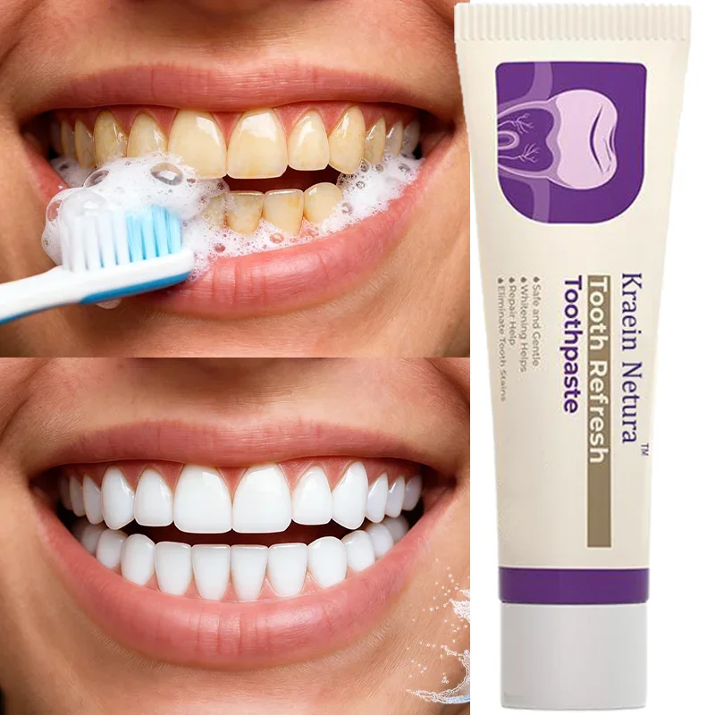 Tooth Refresh Toothpaste for Fresh Breath Prevent Tooth Loss with Natural Ingredients Gentle Care for Tooth Sensitivity Toothach