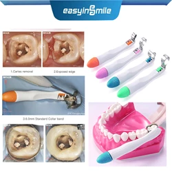 50 adet diş Pro Matrix bantları Easyinsmile önceden oluşturulmuş ayarlanabilir halka matrisleri Molar Premolar 4.5/6MM standart ve kavisli