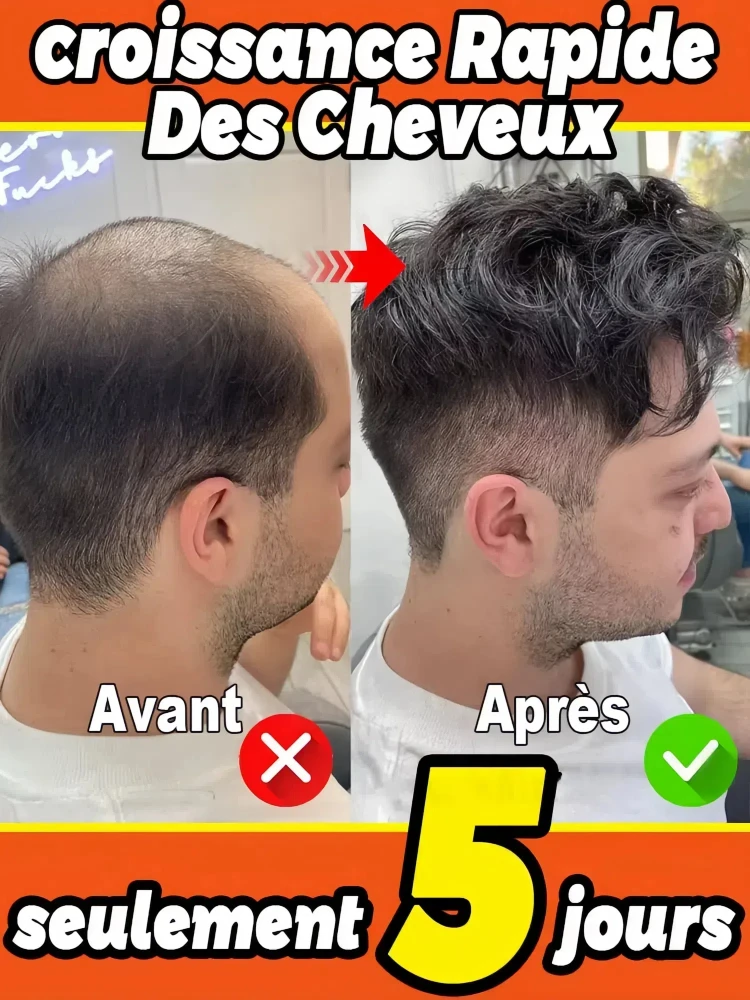 

100% revive hair, strong penetration, activate hair roots, more hair, say goodbye to baldness, thick hair