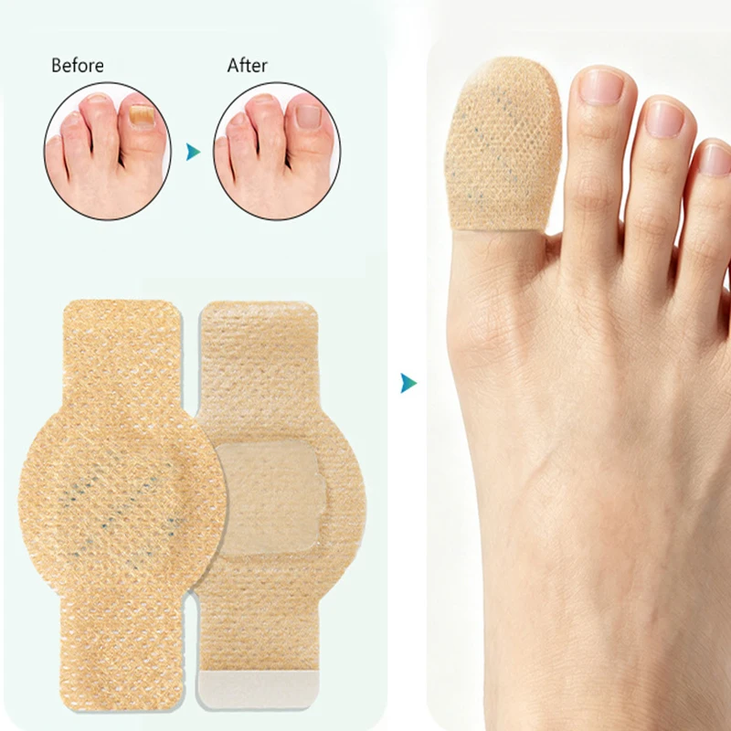 21pcs Waterproof Nail Protector Guard, Breathable Finger Sleeve for Weak or Damaged Nails, Reusable Toe Cap Cover