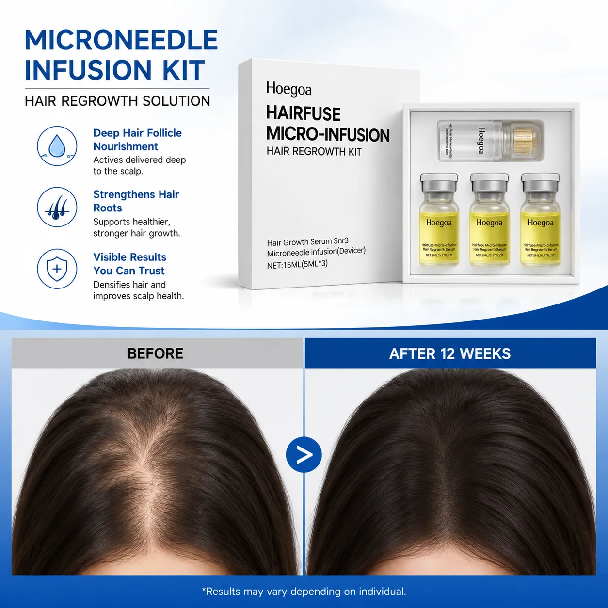 Peine de masaje portátil para - Hair Care Daily Routine reseña y precio