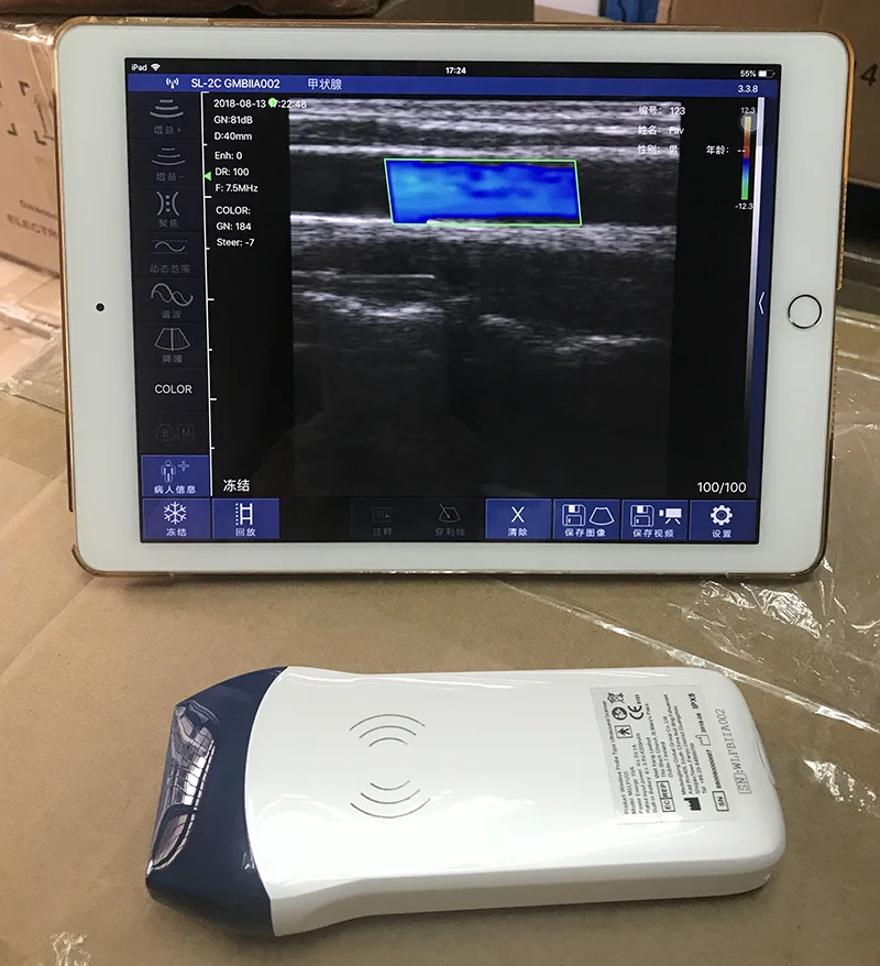 Cheap Deal Mini Handheld Veterinary/Medical Ultrasound Device UP-3C 250g Portable Wireless Probe 3.2/5.0MHz