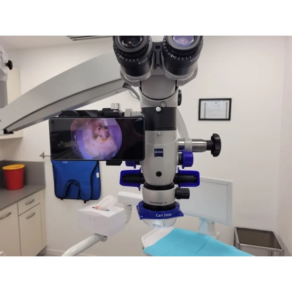 Smartphone Video Adapter for Surgical Microscope Video Recording Alive Video Display