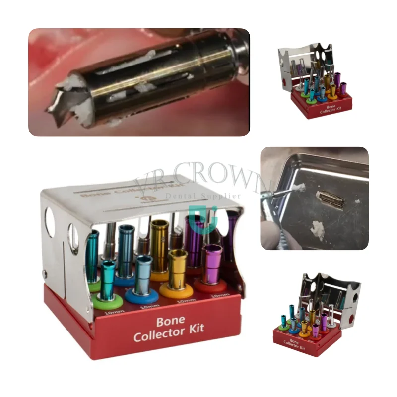 Oneself Bone Collector Kit Dental Bone Collecting Self Bone Collector Implant Kit Chip Marker Drill