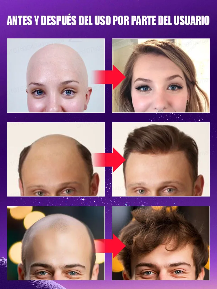 毛包を刺激し、頭皮に栄養を与え、7日間で髪を素早く再生します