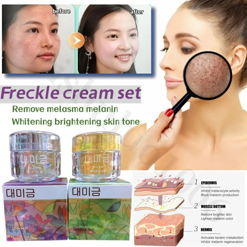 

Strong Bleaching Whitening Face Freckles Remove Corrector Cream Anti-freckle Herbal Whitening Brighten and Moisturizing Set