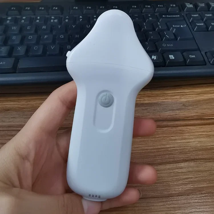 Suresult Portable Handheld Eye Ultrasound Machine for Precise Ocular Imaging