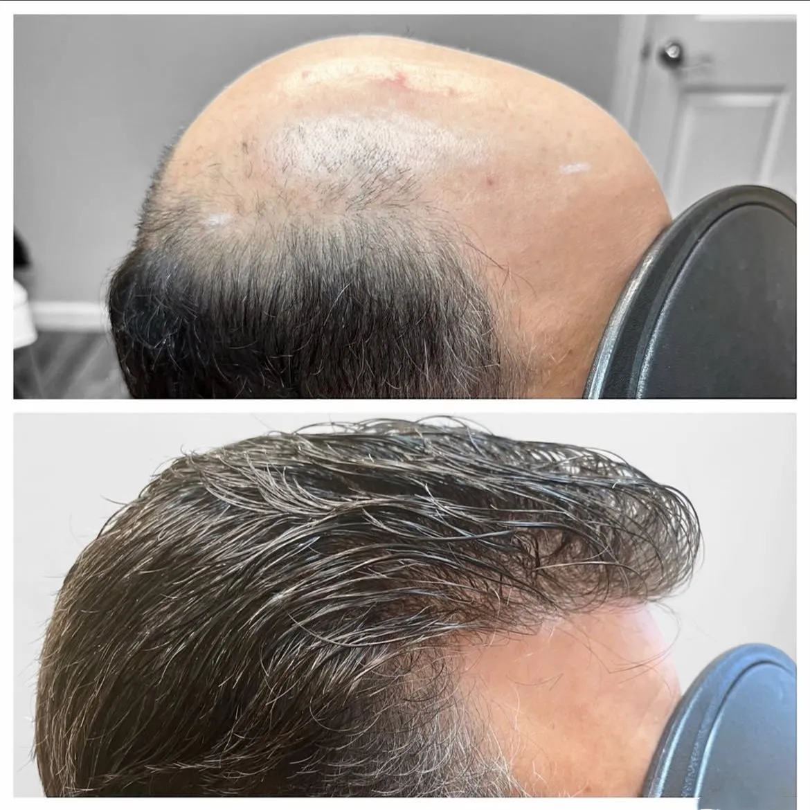 

Натуральная линия волос 0,02-0,03 мм, коричневый, блондин, серый, плотность 80, ультратонкая кожа, невидимый мужской парик, 100, человеческие волосы, капиллярные протези