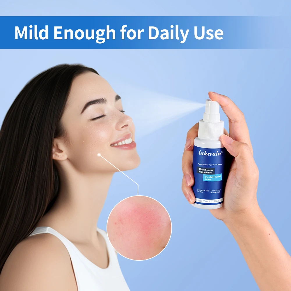 Hypochloorzuur Gezichtsspray Verminder roodheid en acne Post-Workout Cleanser Piercing Nazorg Voor dagelijkse gezichtsredding