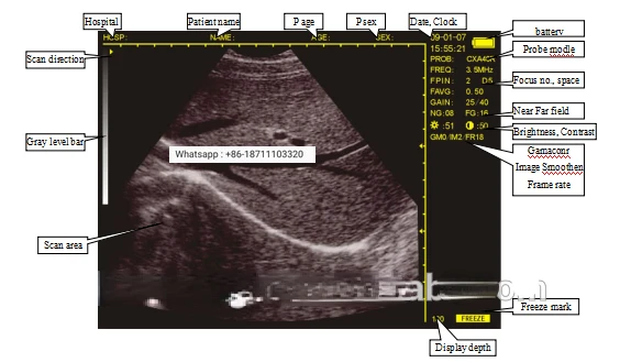 hand held portable veterinary hospital ultrasound scanner device