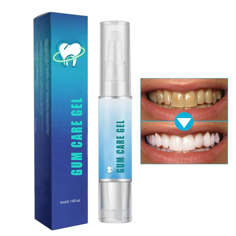 Instant Teeth Brightening Pen Teeth Cleaning Pen Teeth Whtening Toothpaste Pen Tooth Brightening Teeth Stain Remover Oral Care