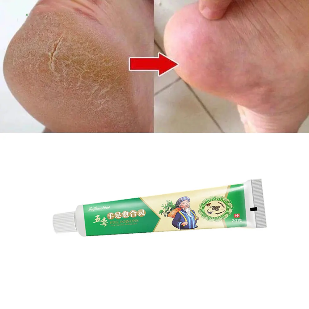 Crème de guérison anti-séchage pour les fissures des mains et des pieds, soin des pieds, réparation des fissures au talon, produits d'outils de soin des pieds, 1 pièce