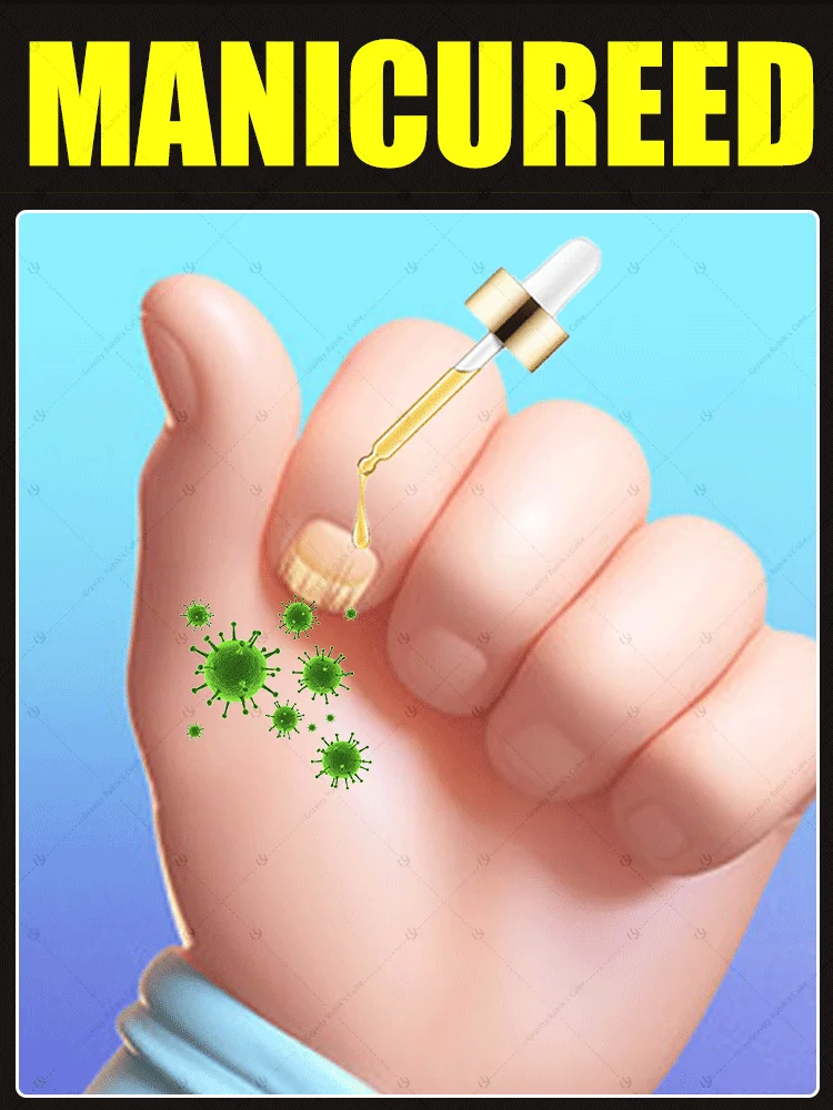 

2025 Hot Sales Multi-functional Nail Repair, Nail Solutions for Discolored and Damaged Nails