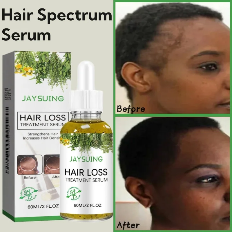 

New Hair Growth Serum African Natural Crazy Hair Regrowth Rosemary Oil Traction Alopecia Treatment Prevent Baldness Women Men