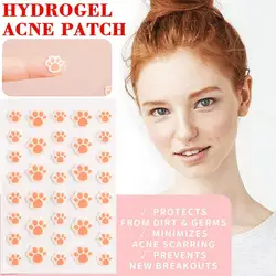 36 Counts Cat Paws Hydrocolloid Acne Pimple Patch Cute Acne Care Cover Patch, Invisible Acne Zit Patches For Face Dots Blemish