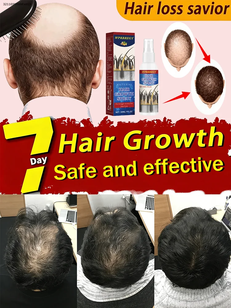

Эфирное масло для роста волос GINGER nourishes hair follicles and promotes thicker hair.