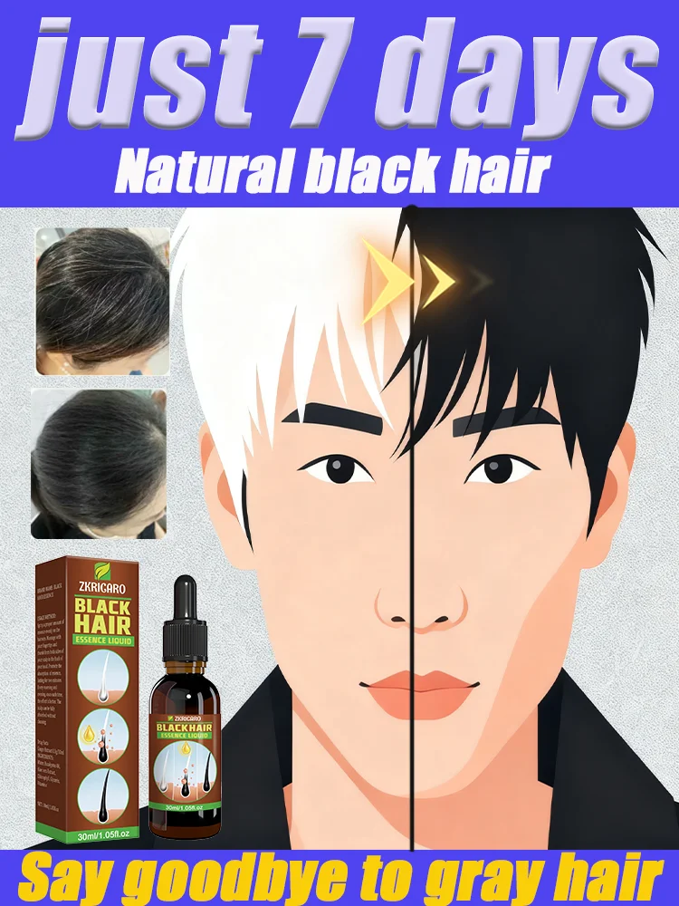 

Nᴏᴜʀɪsʜᴇs ʜᴀɪʀ ʀᴏᴏᴛs, ʟᴇᴀᴠɪɴɢ sᴄᴀʟᴘ ғᴇᴇʟɪɴɢ ʟɪɢʜᴛ ᴀɴᴅ ɴᴀᴛᴜʀᴀʟʟʏ ʙʟᴀᴄᴋ.