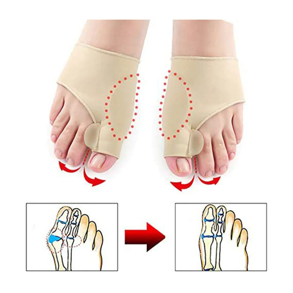 Hallux valgus مصحح ، 2 أجزاء ، تقويم العظام ، العظام ، الإبهام الضابط ، باديكير ، جورب ، مستقيم