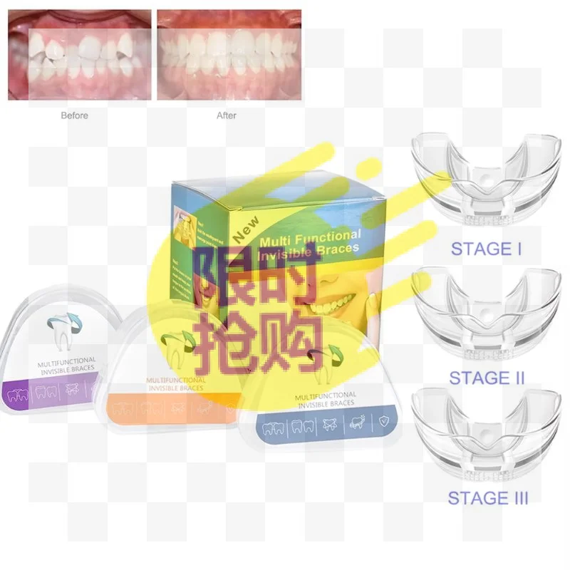 【HBA】Braces Dental Braces Smile Teeth Alignment Trainer Instanted Silicone Teeth Retainer Mouth Guard Braces Tooth Tray