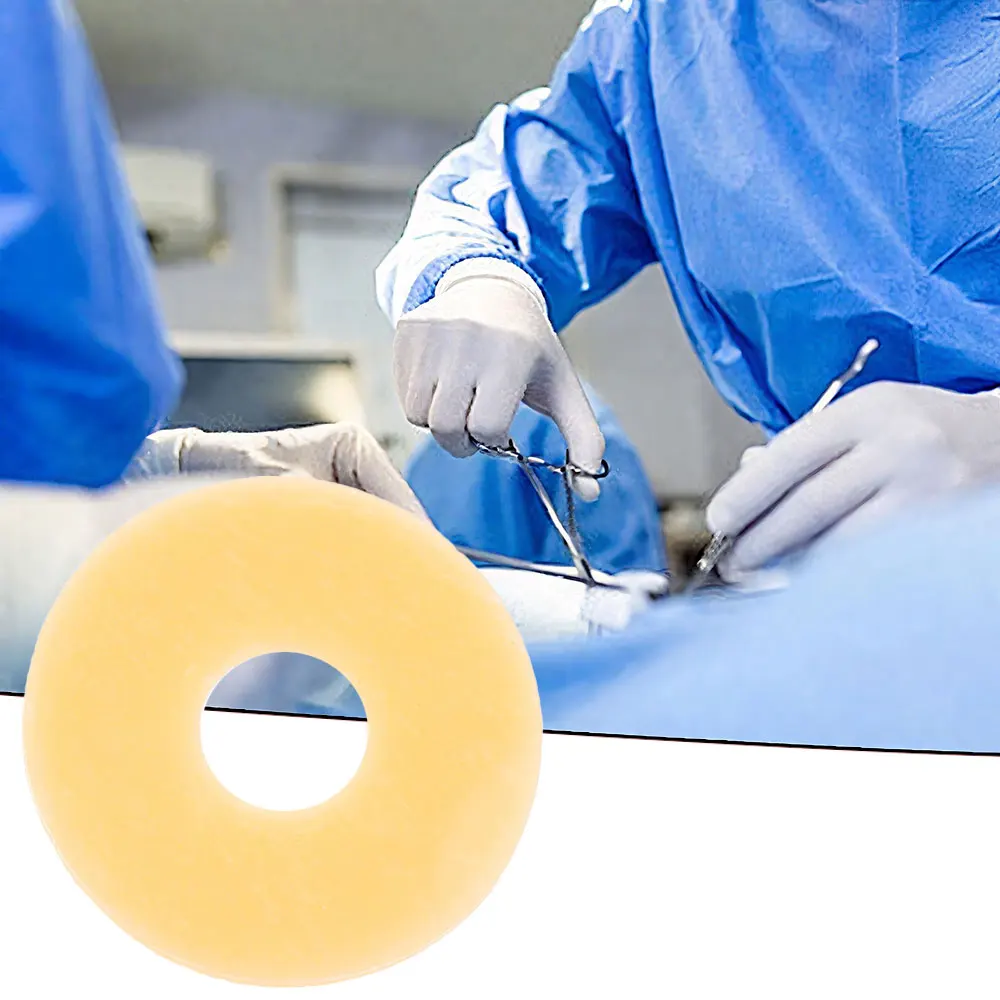 1-10 個人工肛門バッグ漏れ防止リングポータブルストーマバッグ用品保護バリアリングオストミーバッグ支援