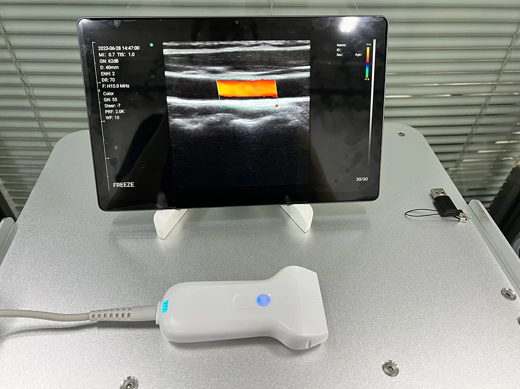 Pocket Veterinary Scanner Android IOS Windows Portable Wifi Wireless Probe Ultrasound