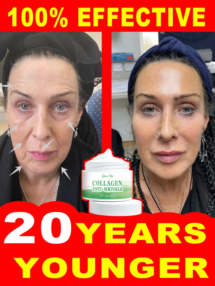 Wrinkles disappear Become beautiful now