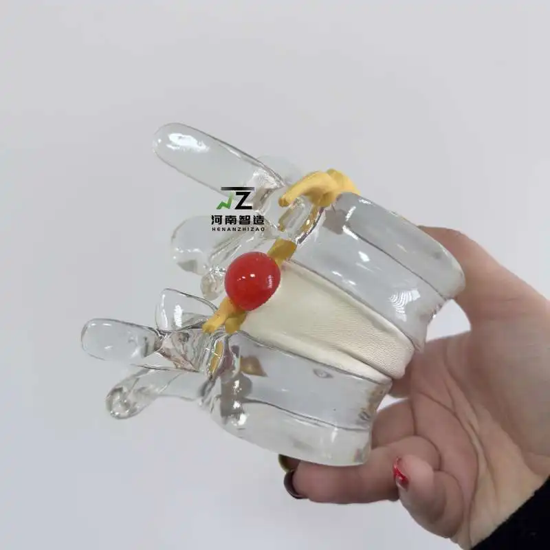 Spine and spinal cord extrusion demonstration model Human medical teaching model Spinal cord bubble ball