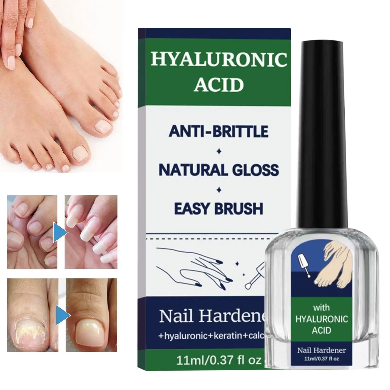 مقوي الأظافر الواقي اللطيف والامتصاص السريع لنمو الأظافر وكيل سائل لأظافر القدم والأصدقاء والزملاء المتحمسين في المنزل