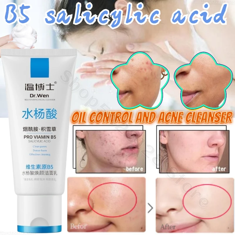 B5 Salicylic Acid Cleanser Oil Control Anti-acne Deep Cleansing Shrinks Pores Repairs Damaged Skin Barrier Facial Cleanser